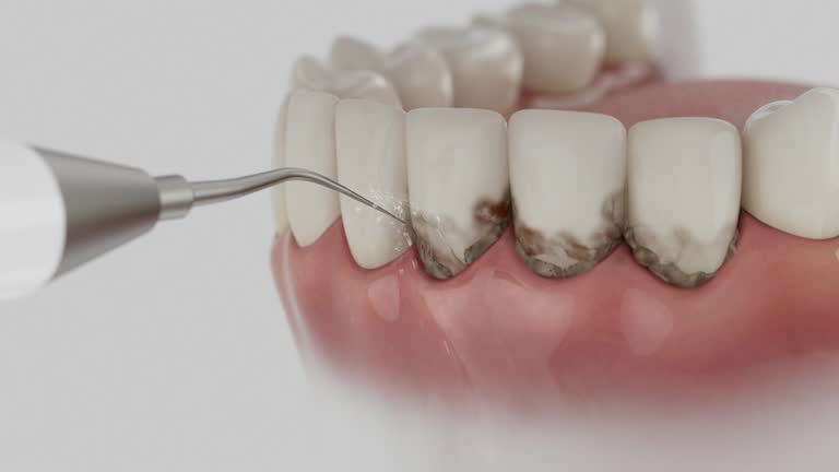 Reliable Dental contractor in Heritage Lake, IN by Dentist Open Now